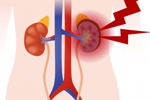 Quels sont les différents types de vascularite ?