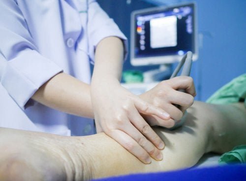 Comment détecter et prévenir la thrombose veineuse profonde ?