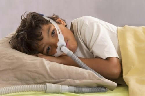 Syndrome de l’apnée obstructive du sommeil chez les enfants