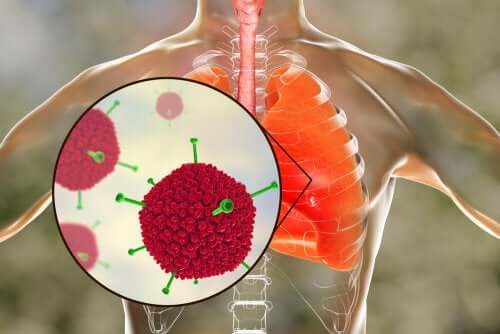Le virus du syndrome respiratoire aigu sévère