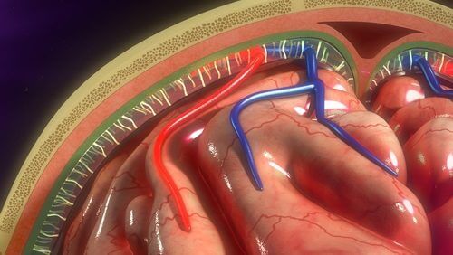 Pompe à perfusion : son utilité et les soins du patient