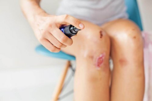 Conseils pour éviter et traiter une blessure