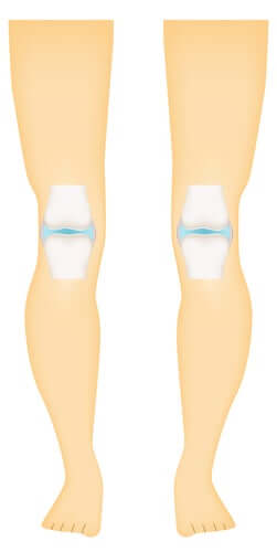 Articulations synoviales : les différents types