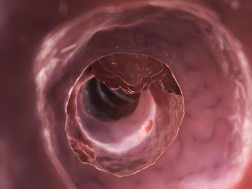 Une illustration de l'intérieur de l'intestin grêle 