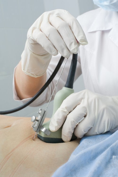 Un médecin qui fait des ultrasons