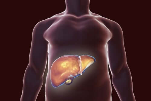 L'alimentation en cas de calculs biliaires