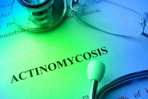 Traitements et prévention de l'actinomycose