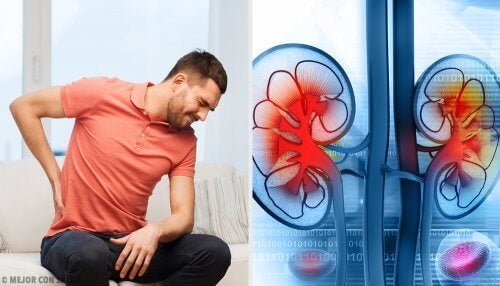 Un homme qui souffre d'un abcès rénal