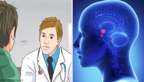 Le schéma de l'adénome hypophysaire