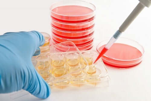Le diagnostic de l'actinomycose