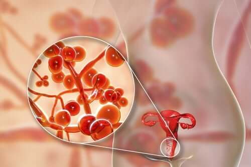 Mycoplasme génital : causes, symptômes et traitement