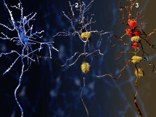 Quels sont les effets du donépézil sur les neurones ?