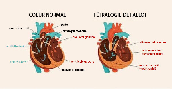 Schémas cardiaques
