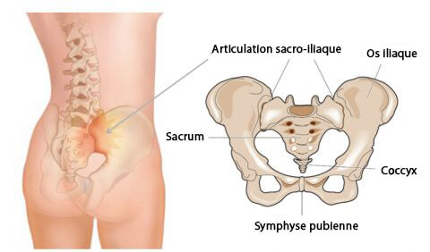 Un schéma de de l'articulation sacro-iliaque