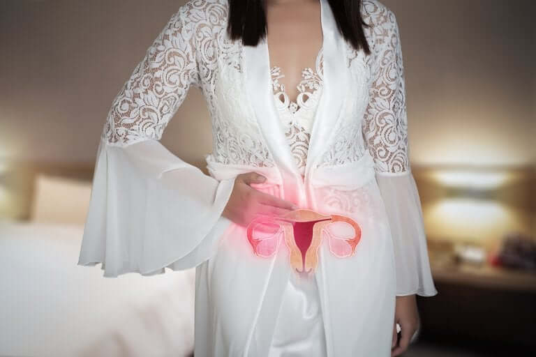 Une femme ayant des polypes utérins