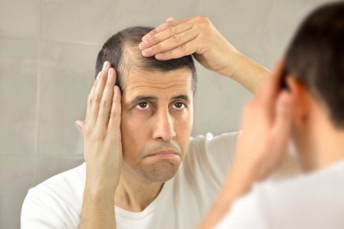 Un homme ayant besoin de minoxidil pour stimuler la pousse de ses cheveux
