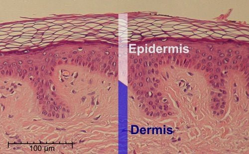 L'acide salicylique peut avoir des effets néfastes sur l'épiderme