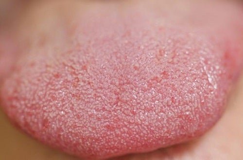 Une langue rouge