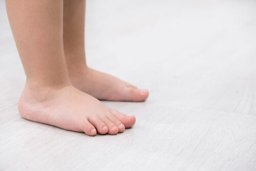 Pieds plats : causes, symptômes et traitements