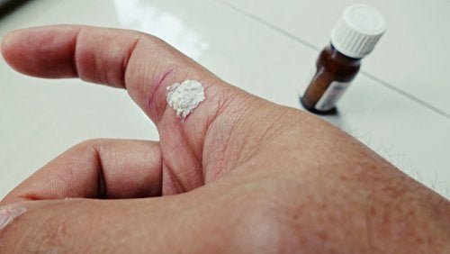 De l'acide salicylique sur un doigt