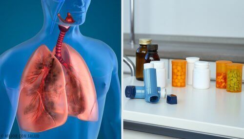 L'aérosolthérapie pour traiter les maladies respiratoires