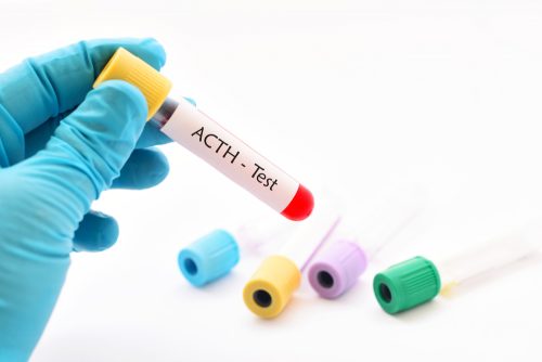 Une analyse médicale de l'ACTH
