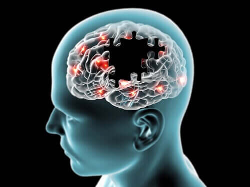 Le sucre et ses effets sur le cerveau