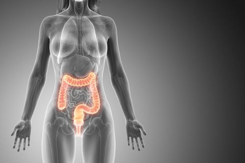 Les polypes se développent dans le côlon