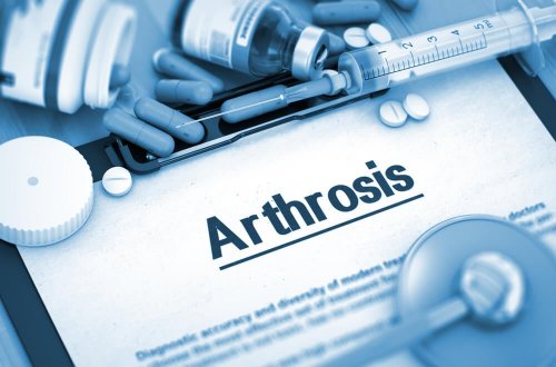 L'étoricoxib est utilisé pour lutter contre l'arthrose