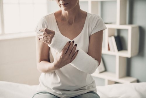 Une femme qui a une fracture du bras
