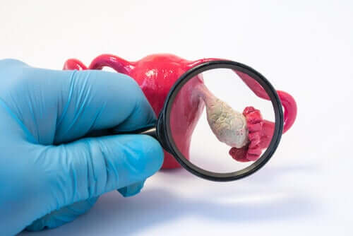 Le diagnostic de l'insuffisance ovarienne primaire