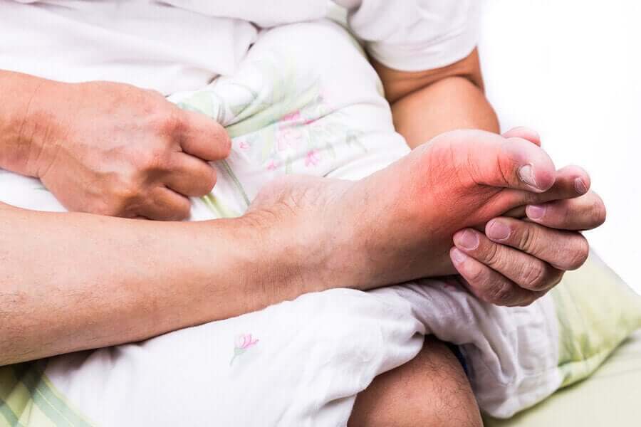 L'allopurinol permet de traiter la goutte