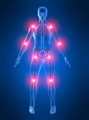 La maladie de Paget est une maladie osseuse