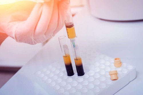 Il existe différents types de thrombocytose