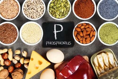 Hyperphosphatémie : causes et traitement