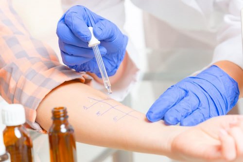 Une analyse pour détecter une allergie 