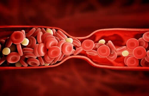 Du cholestérol dans les vaisseaux sanguins