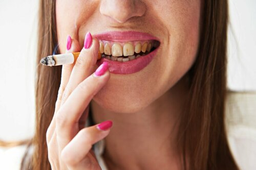 Les dommages du tabac sur les dents