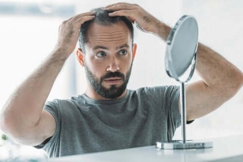 Alopécie androgénique : symptômes, causes et traitement