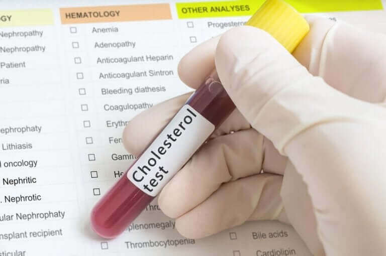 Les régimes contre le cholestérol peuvent être efficaces