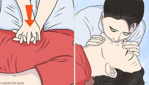 La réanimation cardio-pulmonaire en cas d'AVC