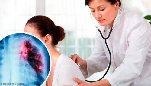 Des examens visant à diagnostiquer un nodule pulmonaire