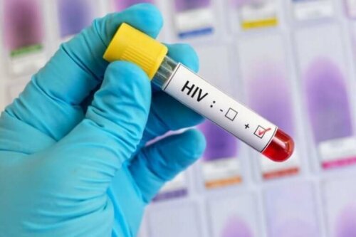 Les analyses à réaliser pour la lutte contre le sida