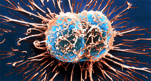 L’action du système immunitaire contre le cancer