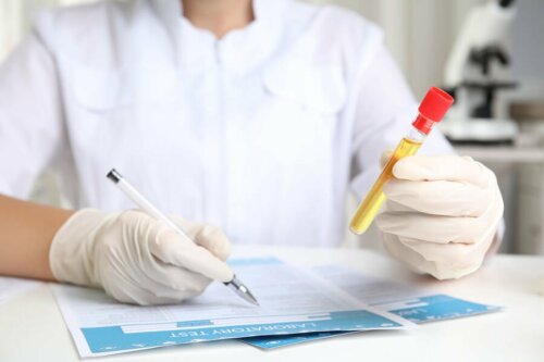 La réalisation d'une analyse d'urine