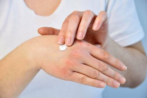 Mettre de la crème sur les mains gercées par le froid