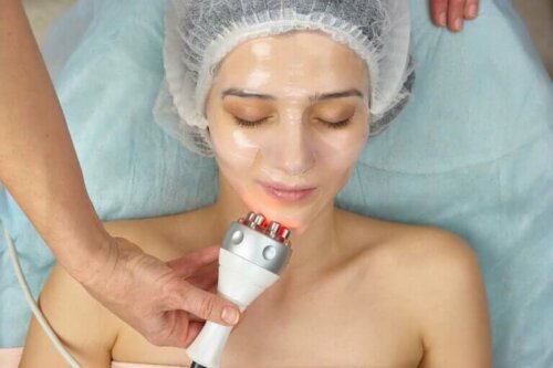 La radiofréquence faciale chez une femme