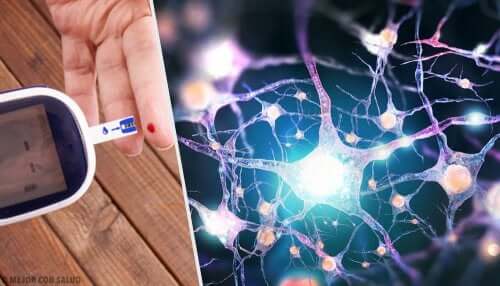Neuropathie diabétique : les huiles essentielles