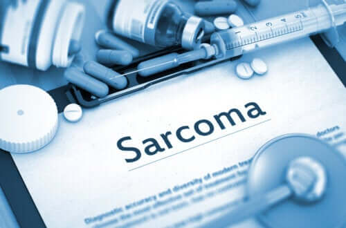 Qu'est-ce qu'un sarcome ? Causes et symptômes