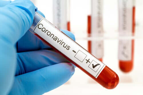 Une analyse de sang pour détecter le coronavirus
